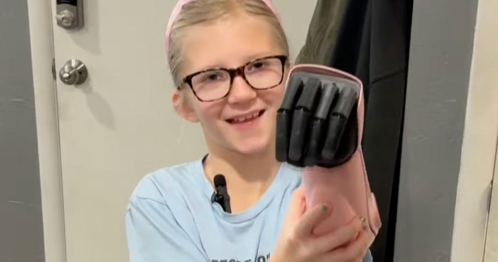 Utah Girl Receives Life-Changing Bionic Arm, Inspires Others to Pay It Forward
