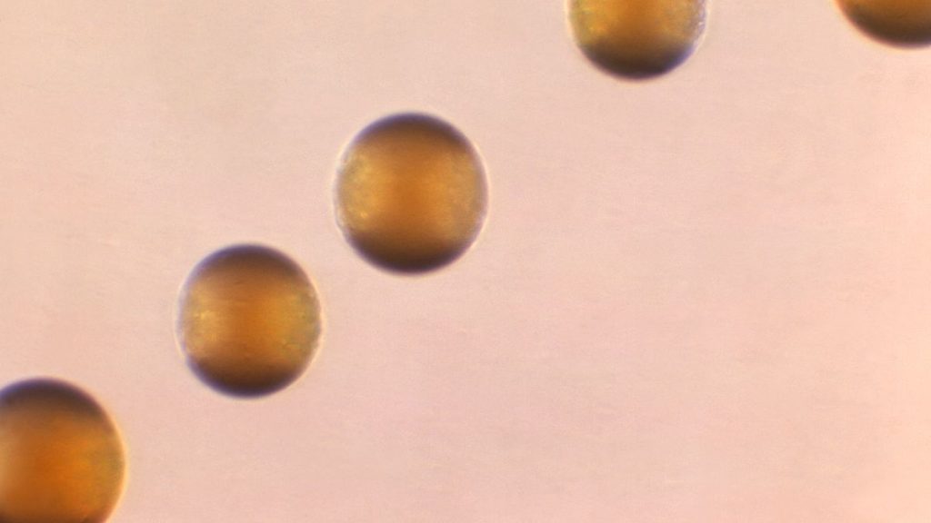 France Calls for Meningitis Vaccination Due to Surge in Cases