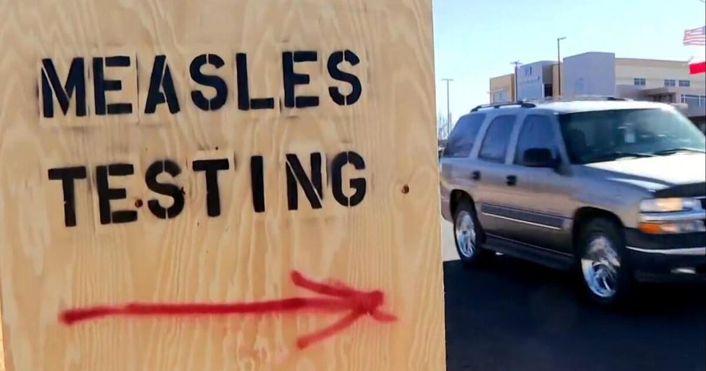 U.S. Sees Highest Measles Cases in a Year Since 2019 Outbreak