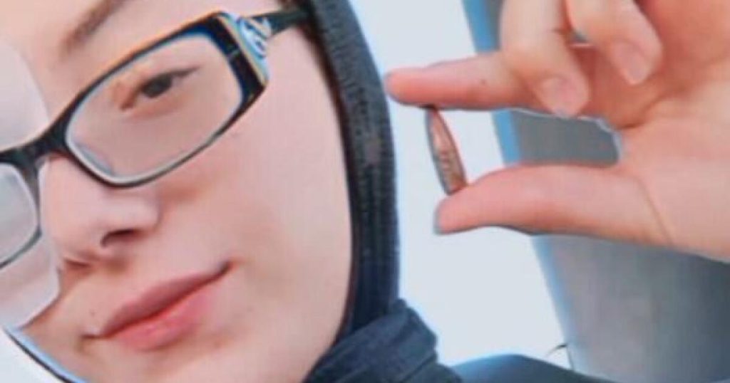 Doctors Successfully Remove Bullet from Palestinian Woman's Head After Four Months