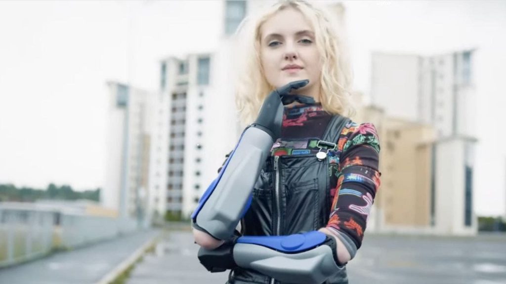 Revolutionary Wireless, Waterproof Bionic Arm Features 360-Degree Wrist Rotation