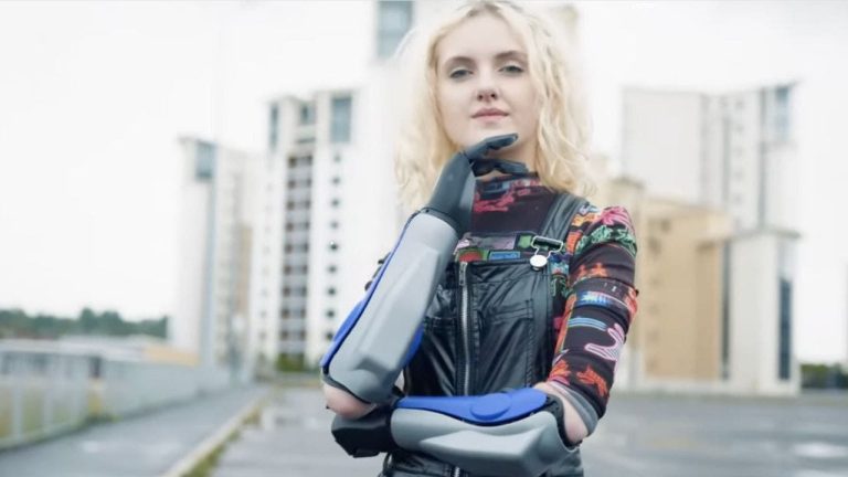 Revolutionary Wireless, Waterproof Bionic Arm Features 360-Degree Wrist Rotation