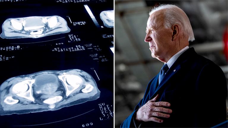 Biden Faces Questions on Prostate Cancer Amid Reports of Outdated PSA Testing