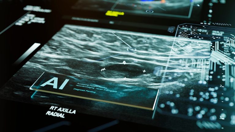 FDA Approves First AI Tool for Predicting Breast Cancer Risk