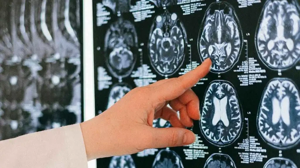 AI Tool Predicts Aging Speed Through Brain Scans AI Tool Predicts Aging Speed Through Brain Scans