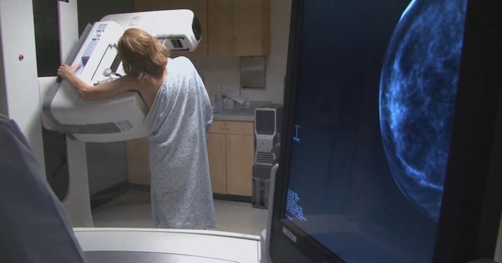 Mammogram Costs Surge, Leaving Women with Unexpected Bills for Preventative Care