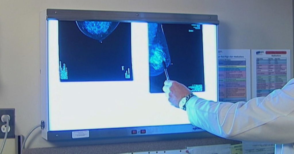 Breast Cancer Survivor Battles Insurer Over Doctor-Recommended Annual Mammograms