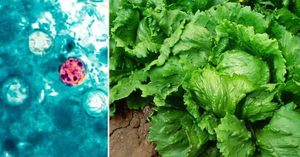 Michigan Health Officials Link Two Deaths to Cyclospora Outbreak in Patients with Pre-existing Conditions