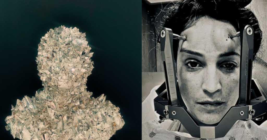 Artist Transforms Harrowing Health Struggle with Incurable Disease into Unique Art After MRI Diagnosis Artist Transforms Harrowing Health Struggle with Incurable Disease into Unique Art After MRI Diagnosis